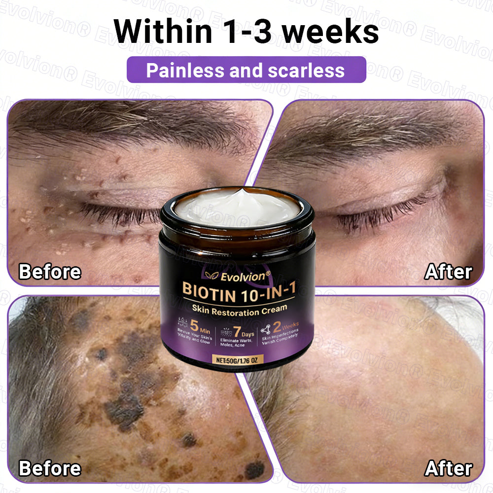 Made and Shipped from UK ✨Evolvion® Biotin 10-in-1 Skin Restoration Cream🍀🍀