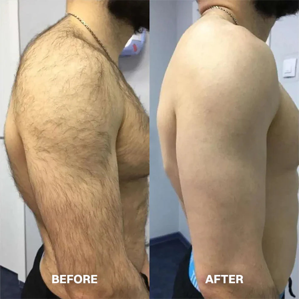 Hair Removal Cream for All Women & Men🍇