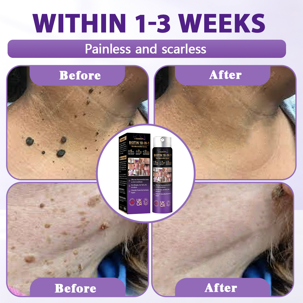 Made and shipped from the United Kingdom ✨Evolvion® Biotin 10-in-1 Skin Restoration Spray✨✨