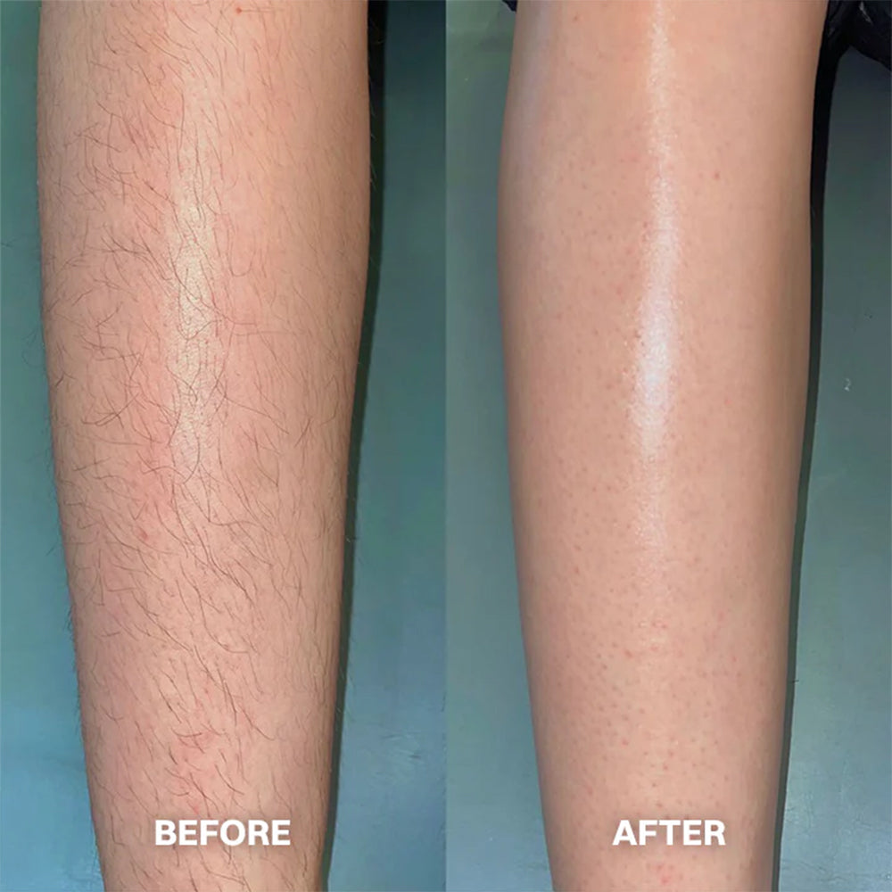 Hair Removal Cream for All Women & Men🍇