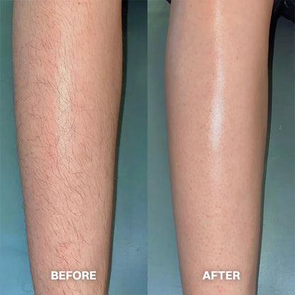 Hair Removal Cream for All Women & Men🍇