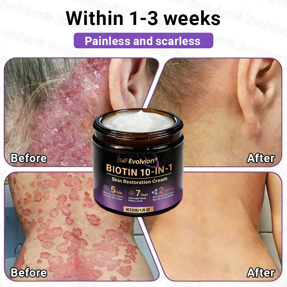 Made and Shipped from UK ✨Evolvion® Biotin 10-in-1 Skin Restoration Cream🍀🍀