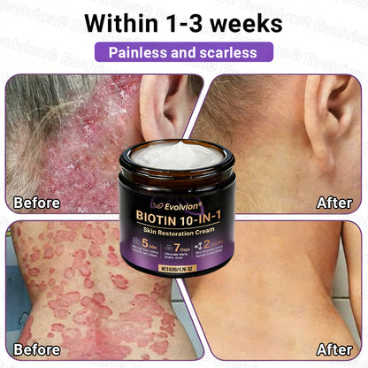 Made and Shipped from UK ✨Evolvion® Biotin 10-in-1 Skin Restoration Cream🍀🍀