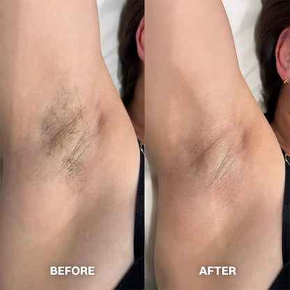 Hair Removal Cream for All Women & Men🍇
