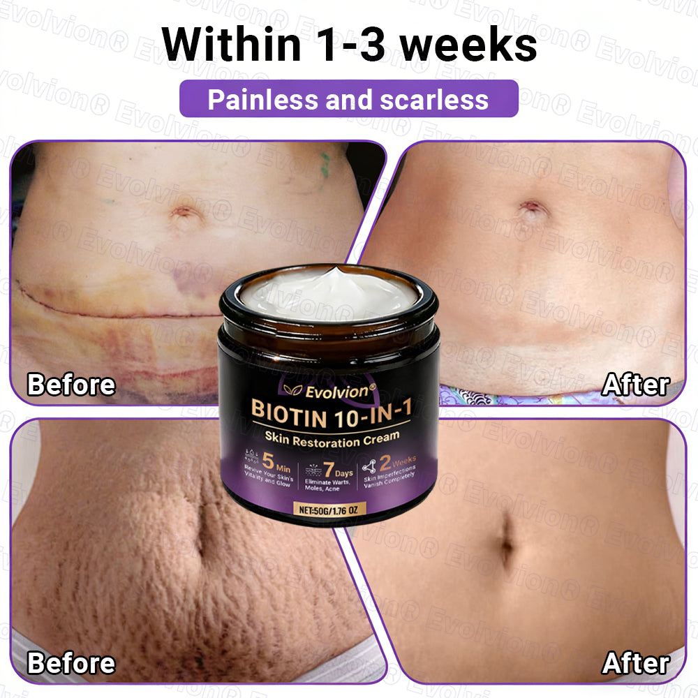 Made and Shipped from UK ✨Evolvion® Biotin 10-in-1 Skin Restoration Cream🍀🍀