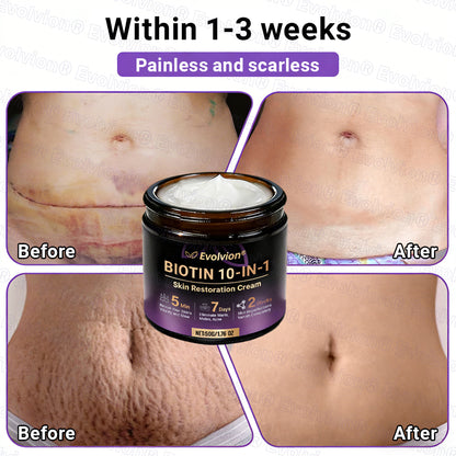 Made and Shipped from UK ✨Evolvion® Biotin 10-in-1 Skin Restoration Cream🍀🍀