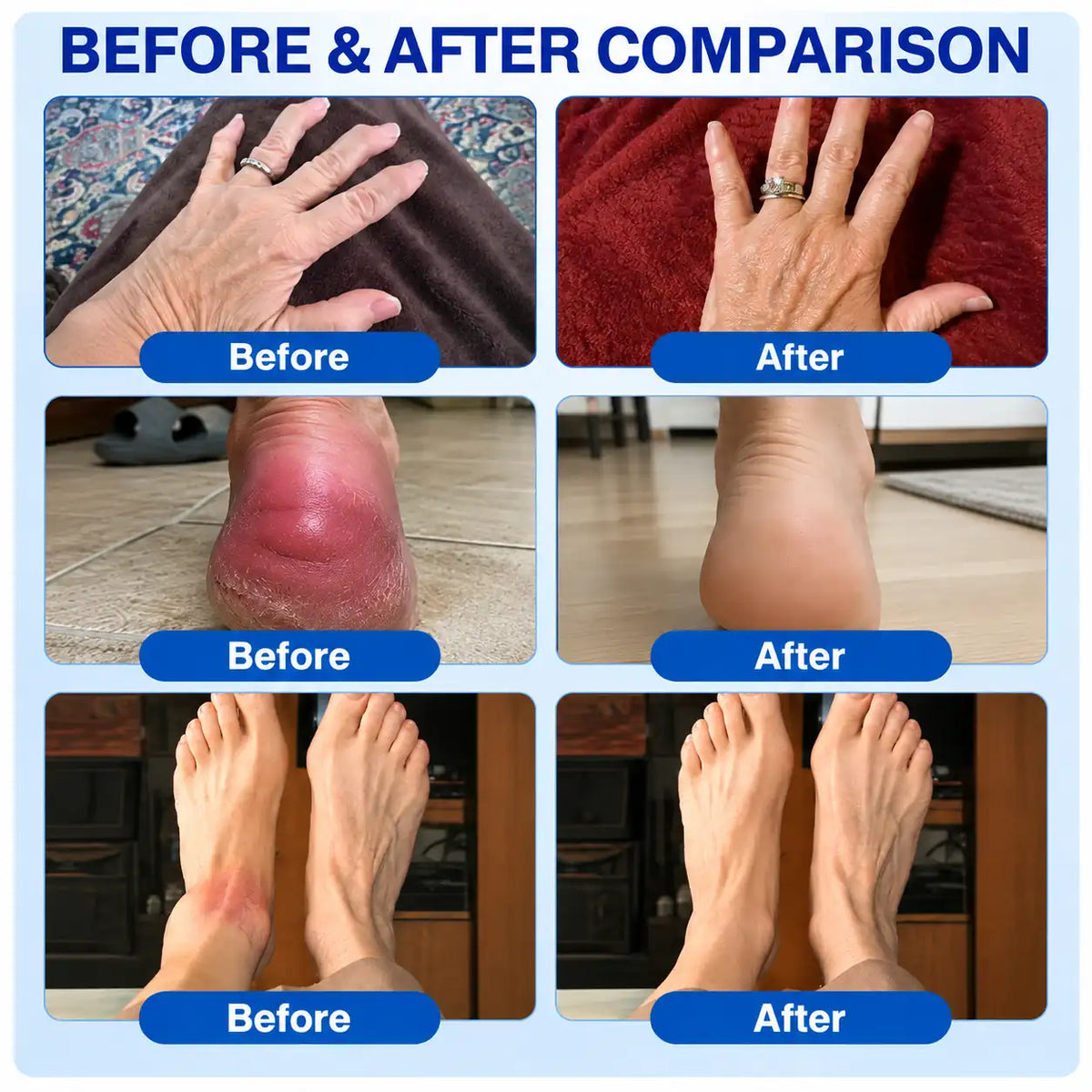 🦵 💎GFOUK® ArthriCare — Diclofenac Advanced Joint Comfort & Mobility Cream