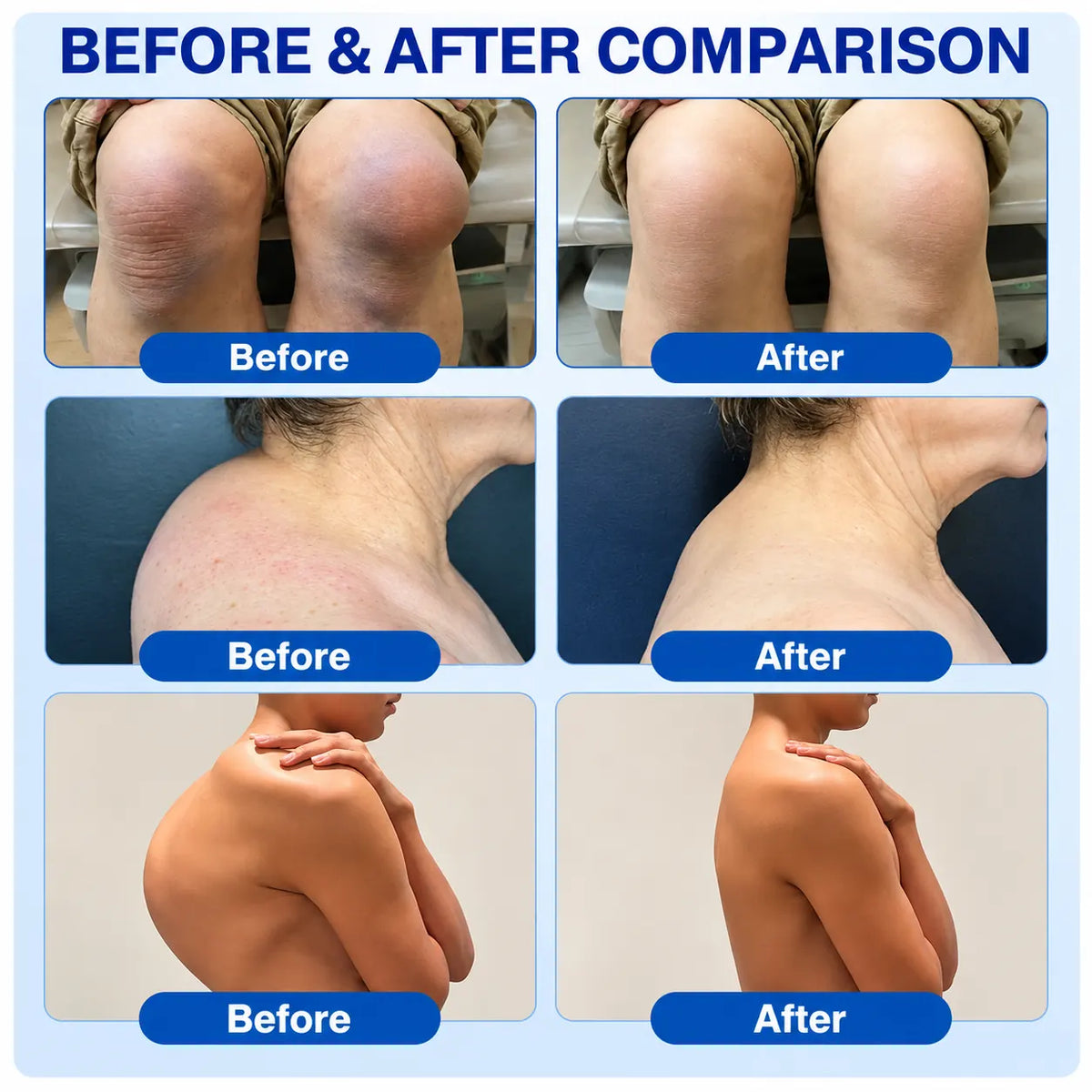 🦵 💎GFOUK® ArthriCare — Diclofenac Advanced Joint Comfort & Mobility Cream