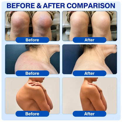 🦵 💎GFOUK® ArthriCare — Diclofenac Advanced Joint Comfort & Mobility Cream