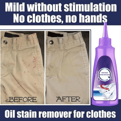 Active Enzyme Laundry Stain Remover🐋
