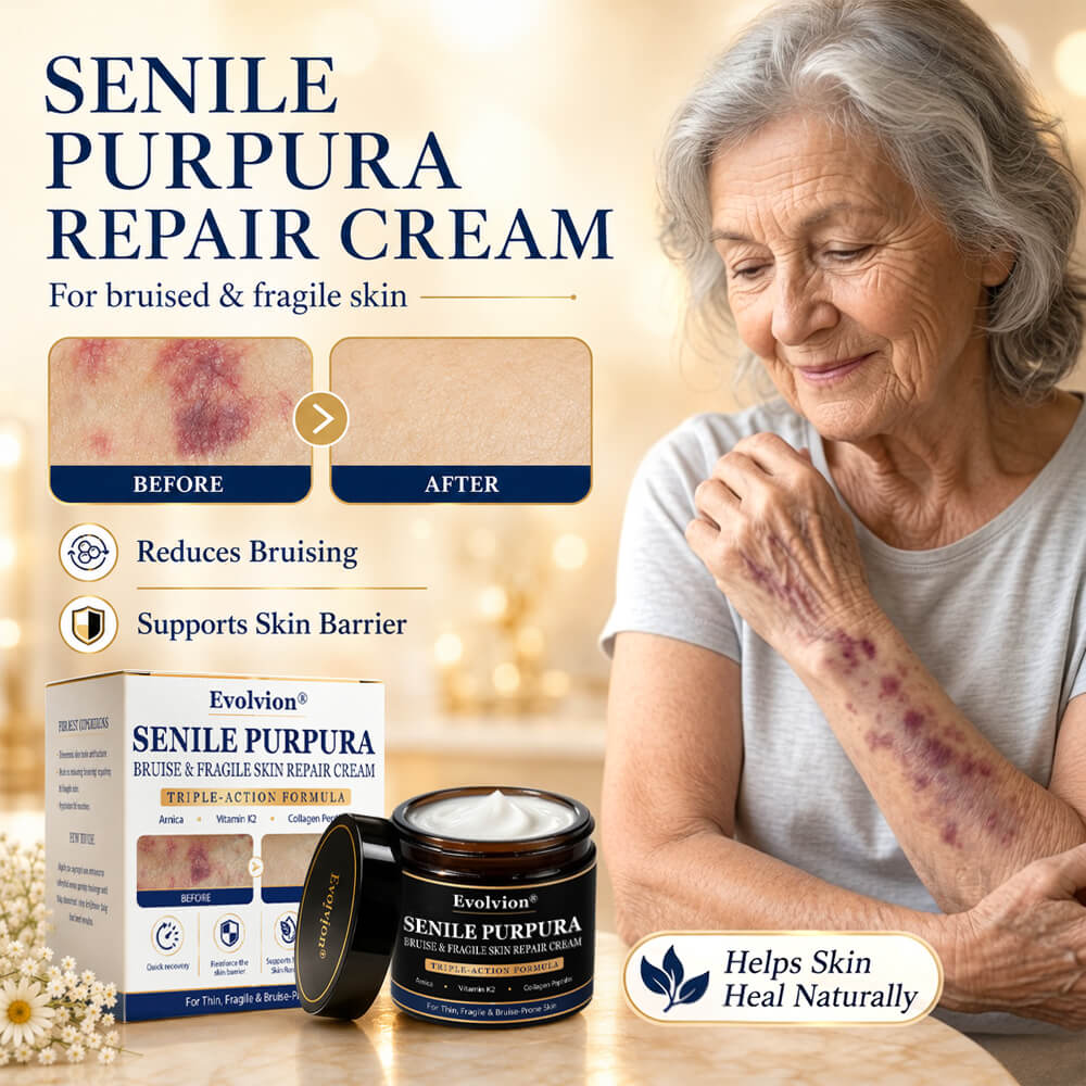 ✨Evolvion® Senile Purpura, Bruise & Fragile Skin Repair Cream🌵