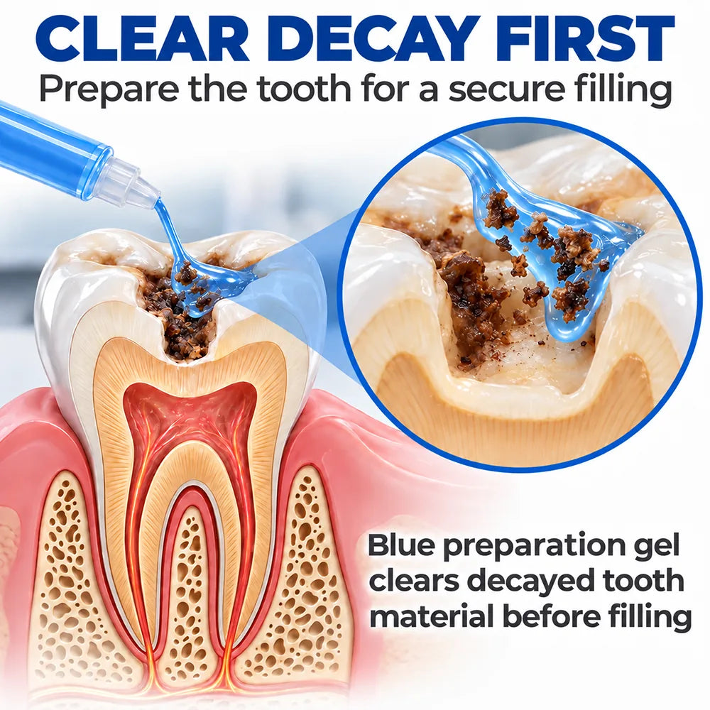 Dr.Fachmer® DentRestore Tooth Repair & Filling System 🌺