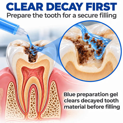Dr.Fachmer® DentRestore Tooth Repair & Filling System 🌺