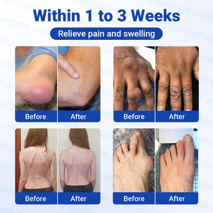 𝐎𝐟𝐟𝐢𝐜𝐢𝐚𝐥 𝐒𝐭𝐨𝐫𝐞 🇬🇧 | GFOUK® BPC-157 × NSAID 10-in-1 Penetrating Greaseless Arthritis Gel