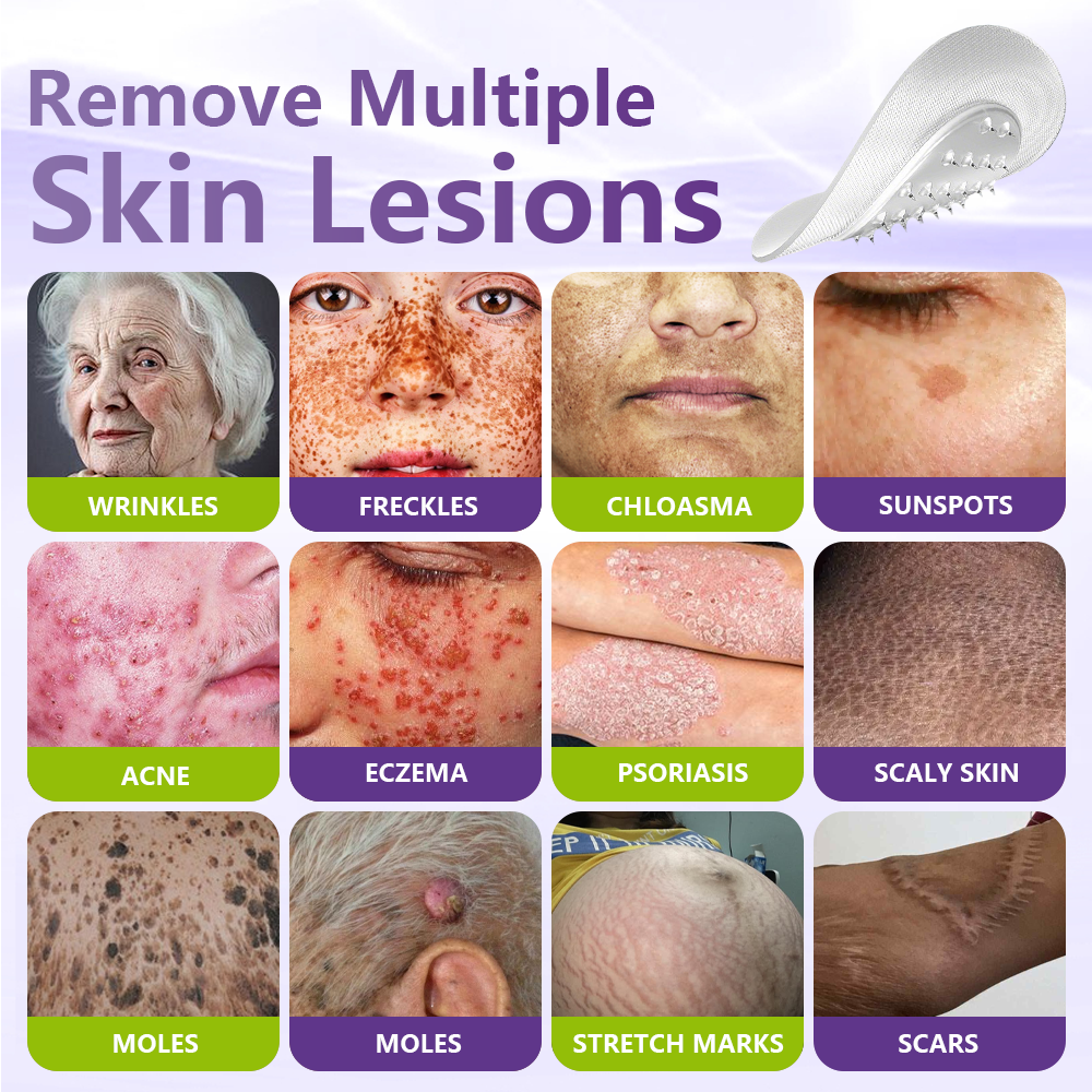 GFOUK® Soluble Microneedle Botanical Skin Tag Removal Patch🌴