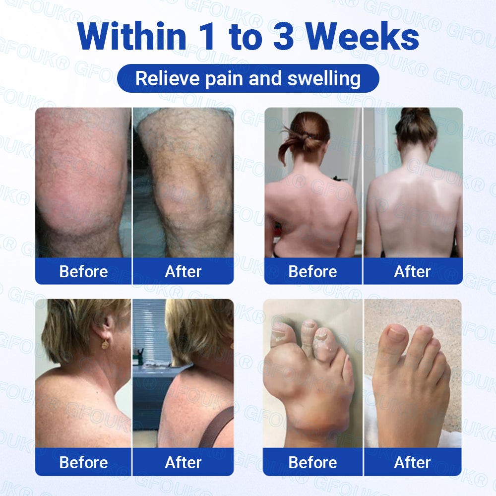 𝐎𝐟𝐟𝐢𝐜𝐢𝐚𝐥 𝐒𝐭𝐨𝐫𝐞 🇬🇧 | GFOUK® BPC-157 × NSAID 10-in-1 Penetrating Greaseless Arthritis Gel