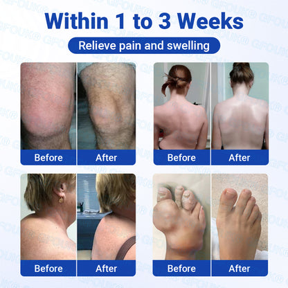 𝐎𝐟𝐟𝐢𝐜𝐢𝐚𝐥 𝐒𝐭𝐨𝐫𝐞 🇬🇧 | GFOUK® BPC-157 × NSAID 10-in-1 Penetrating Greaseless Arthritis Gel