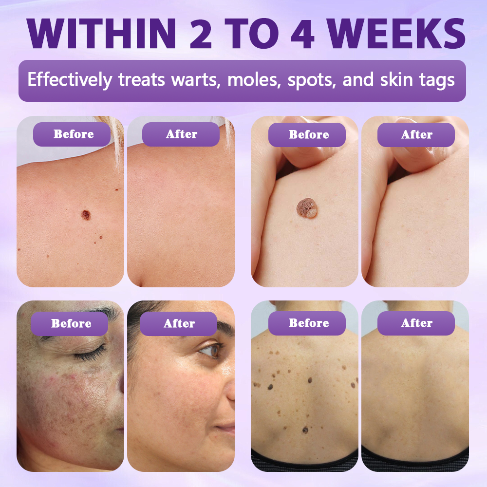 Made and shipped from the United Kingdom ✨Evolvion® Biotin 10-in-1 Skin Restoration Spray-up