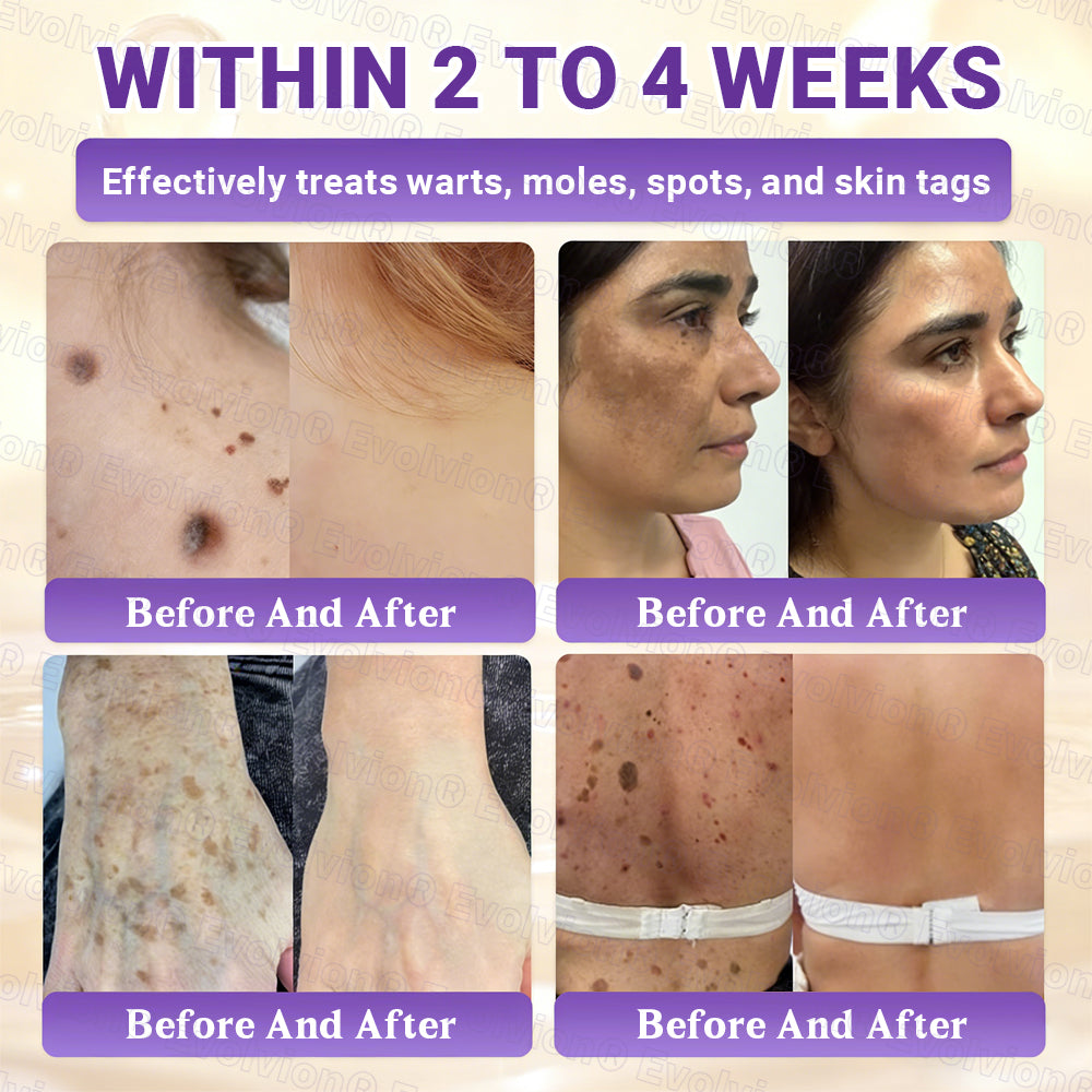 Made and Shipped from UK ✨Evolvion® Biotin 10-in-1 Skin Restoration Cream🍀🍀