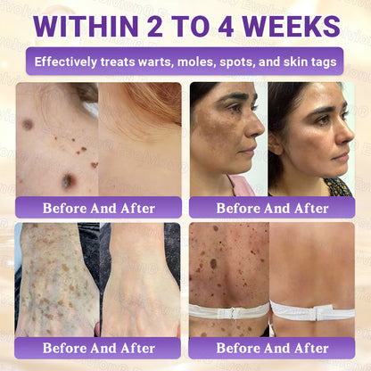 Made and Shipped from UK ✨Evolvion® Biotin 10-in-1 Skin Restoration Cream🍀🍀