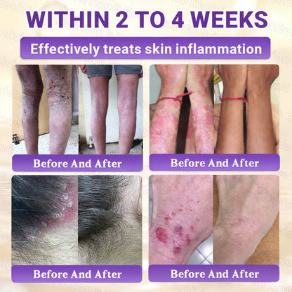 Made and Shipped from UK ✨Evolvion® Biotin 10-in-1 Skin Restoration Cream🍀🍀