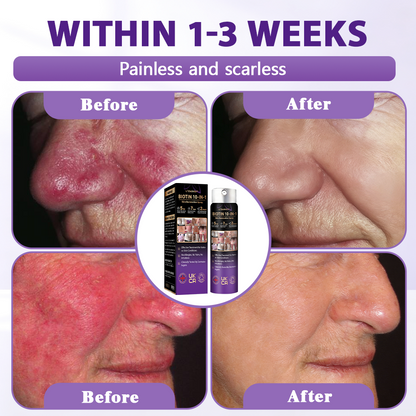 Made and shipped from the United Kingdom ✨Evolvion® Biotin 10-in-1 Skin Restoration Spray-up