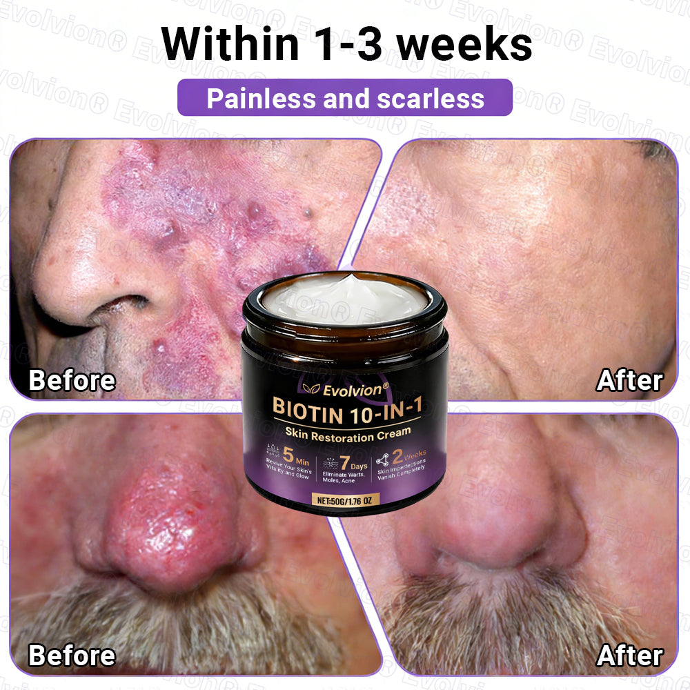 Made and Shipped from UK ✨Evolvion® Biotin 10-in-1 Skin Restoration Cream🍀🍀