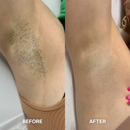 Hair Removal Cream for All Women & Men🍇