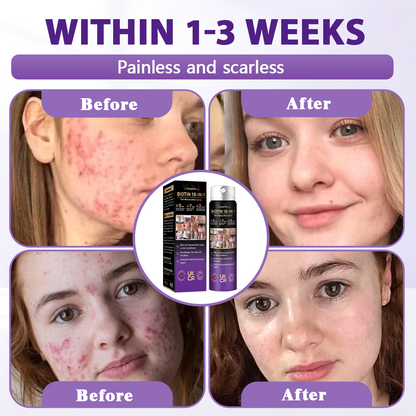 Made and shipped from the United Kingdom ✨Evolvion® Biotin 10-in-1 Skin Restoration Spray✨