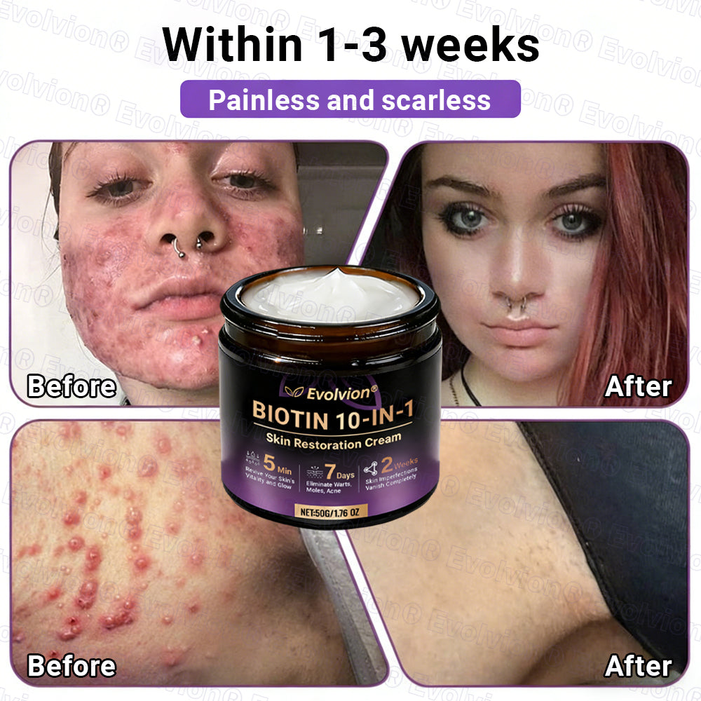 Made and Shipped from UK ✨Evolvion® Biotin 10-in-1 Skin Restoration Cream🍀🍀