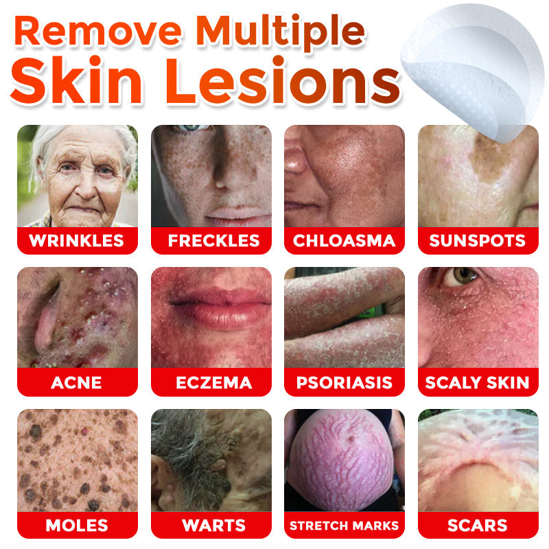 🇬🇧GFOUK® MicroNeedle Botanic Skin Tag Removal Patch