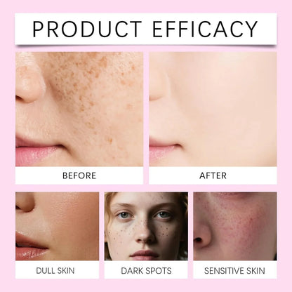 ✨ Tranexamic Acid Brightening Cream