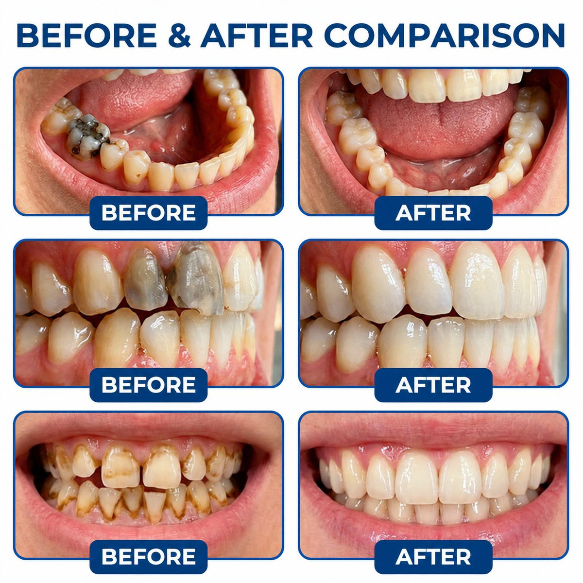 Dr.Fachmer® DentRestore Tooth Repair & Filling System 🌺