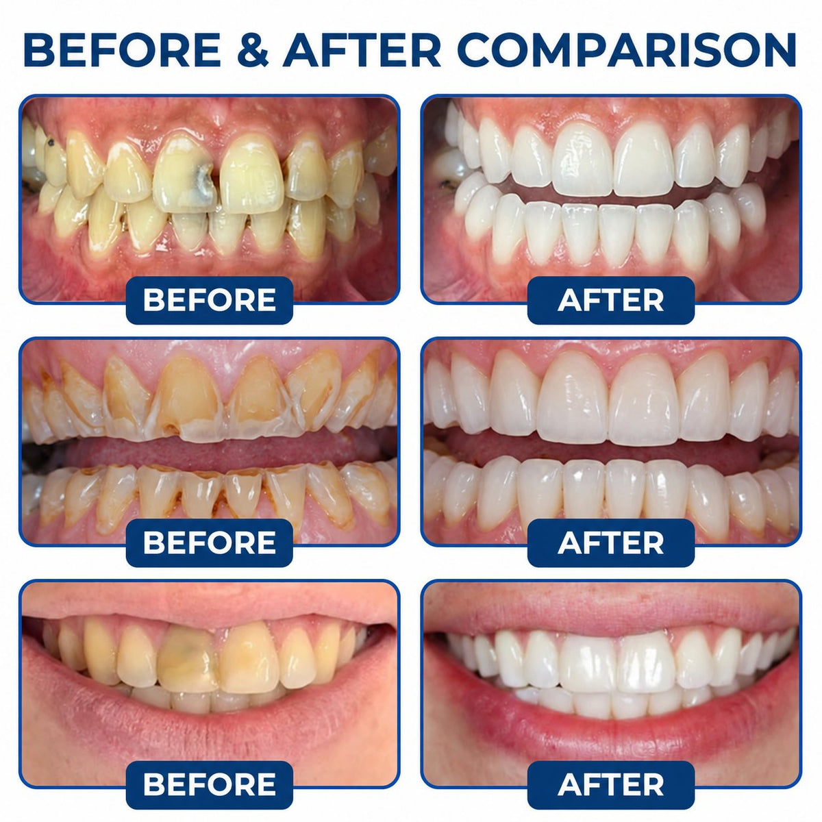 Dr.Fachmer® DentRestore Tooth Repair & Filling System 🌺